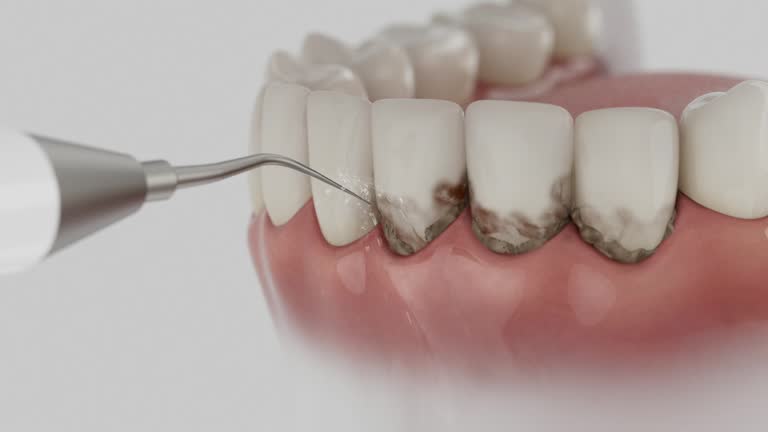 Reliable Dental contractor in Monterey, TN by Dentist Open Now